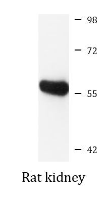 Anti-ALDH7A1
