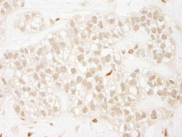 Anti-ZEB1 (IHC)