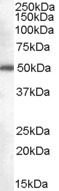 Anti-DDX6, C-terminal