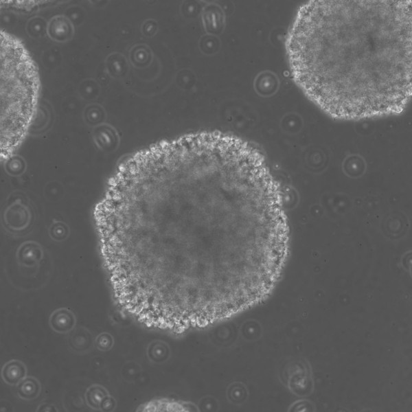 B-LCL-CDG2 Cells