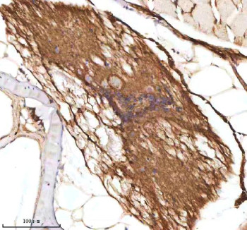 Anti-Zebrafish Axin2 / Axis inhibition protein 2