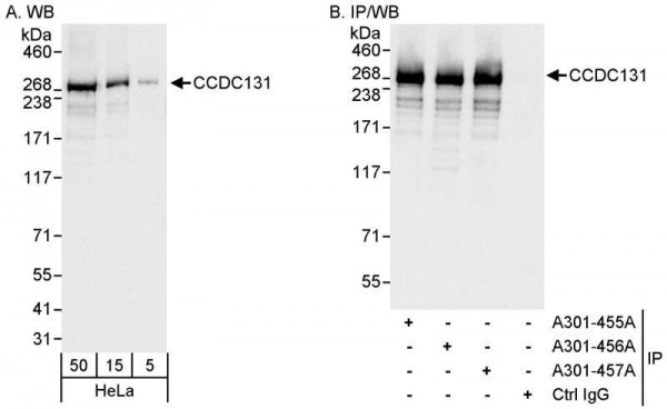 Anti-CCDC131