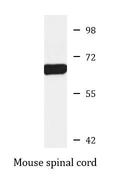 Anti-Norepinephrine Transporter