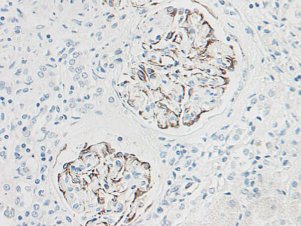 Anti-Lymphotactin