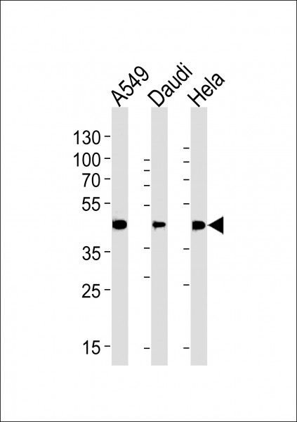 Anti-ALDH3A1