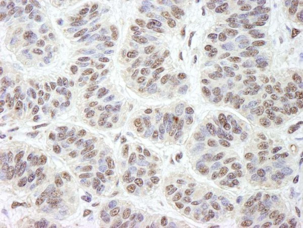 Anti-GNL3 (IHC)