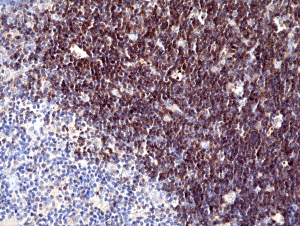 Anti-CD1a (human), Rabbit Monoclonal (RM393)