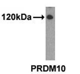 Anti-PRDM10, clone 48AT1224.90.46