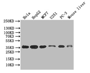 Anti-ANXA4 Recombinant Monoclonal, clone 31D6