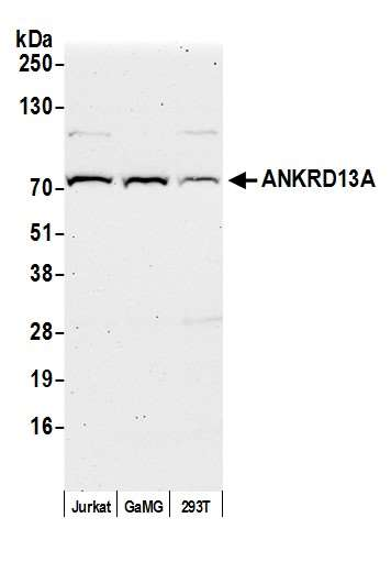 Anti-ANKRD13A