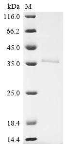 Retinaldehyde-binding protein 1 (RLBP1), recombinant human