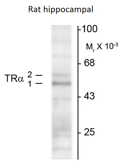 Anti-Thyroid Hormone Receptor alpha, clone 2103