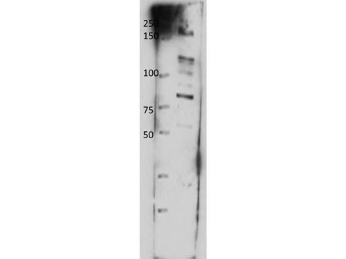 Anti-ABCB8