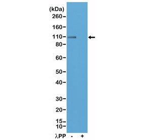 Anti-phospho-Glutamate Receptor 1 / GLUR1(Ser845) (recombinant antibody), clone RM296