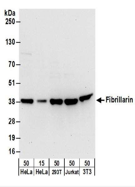 Anti-Fibrillarin