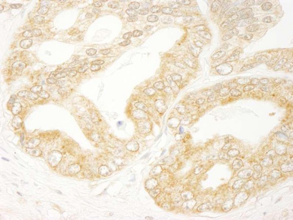 Anti-eIF4H (IHC)