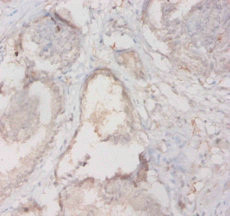Anti-HLA-DQA2