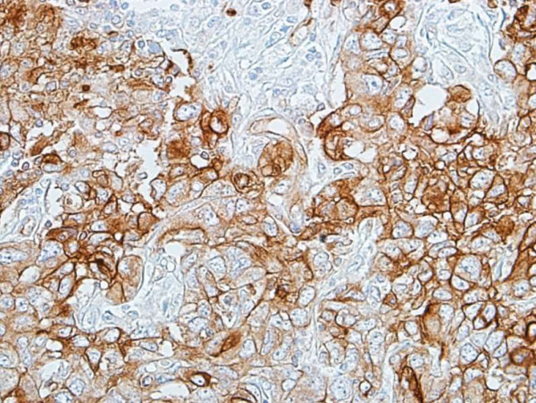 Anti-CEACAM1 Recombinant Monoclonal