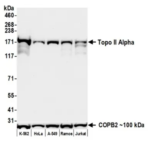 Anti-Topo II Alpha Recombinant Monoclonal