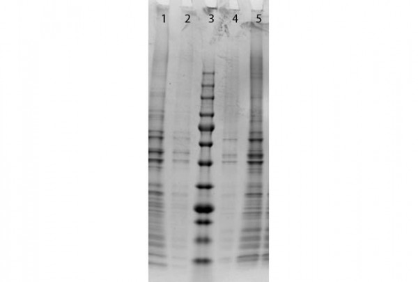 Normal Mouse Pancreas Whole Cell Lysate