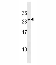 Anti-Erythropoietin