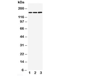 Anti-NMDAR2B