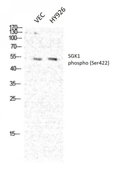 Anti-phospho-SGK1 (Ser422)