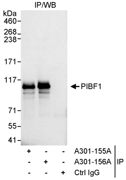 Anti-PIBF