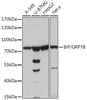 Anti-BiP/GRP78