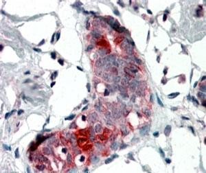 Anti-Mammaglobin A