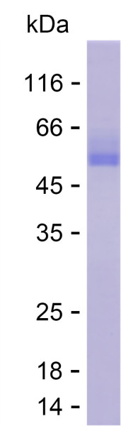 Recombinant Human PCB Protein