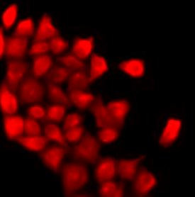 Anti-DBP / Vitamin D Binding protein