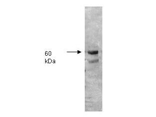 Anti-Phosphatase, Alkaline, human intestine