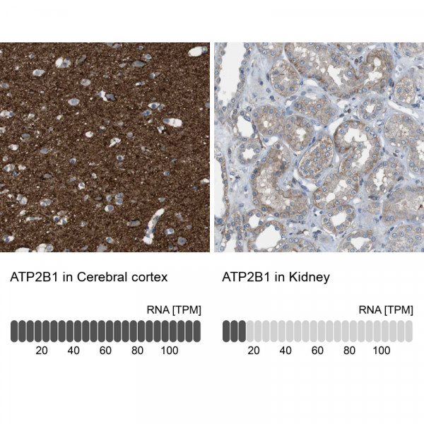 Anti-ATP2B1