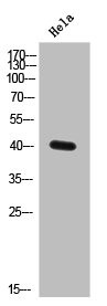Anti-ELAVL2/ELAVL4
