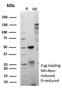 Anti-ERG / Erythroblast transformation specific related gene, clone ERG/9604R