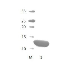 SNX27 PDZ Domain