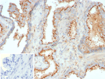 Anti-LGALS9 / Galectin 9, clone LGALS9/7689