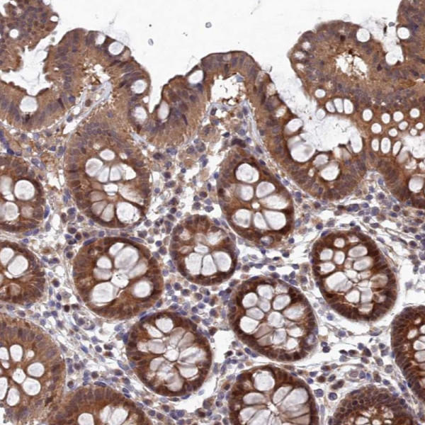 Anti-ELOVL6