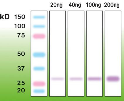 Anti-Trypsin, clone A16-N