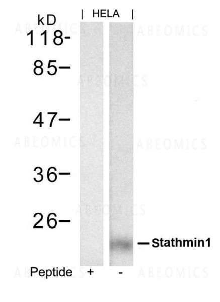 Anti-stathmin1 (Ab-62)