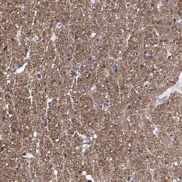 Anti-CNTN1