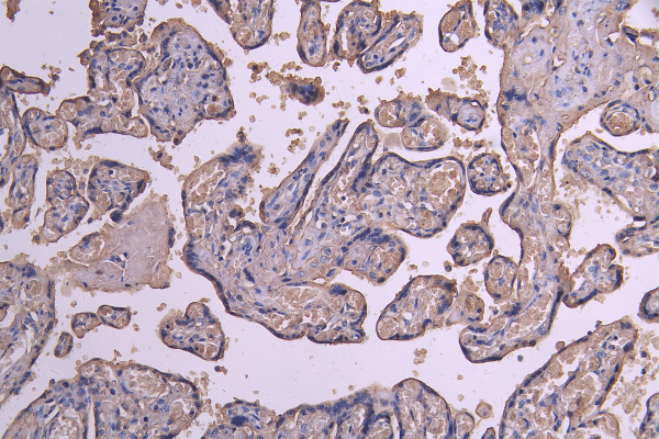Anti-ACVR2B, recombinant clone 7E5