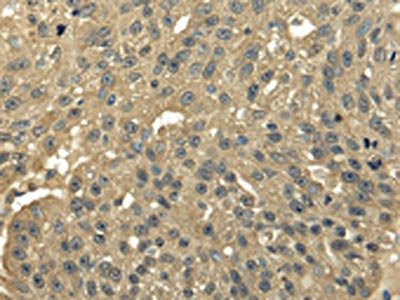 Anti-TFDP2