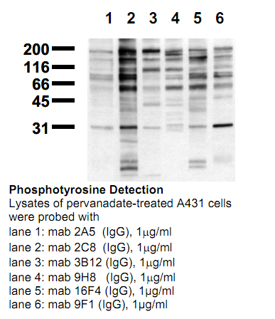 Anti-Phosphotyrosine, clone 2A5