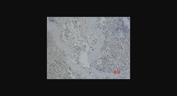 Anti-CD41/Integrin alpha/2b, monoclonal