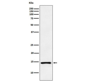 Anti-Atrial Natriuretic Peptide/Factor, clone ADHD-14