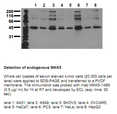 Anti-MKK5 (N-term), clone 14B5