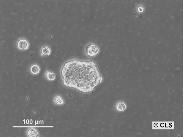 HROC364 Cells