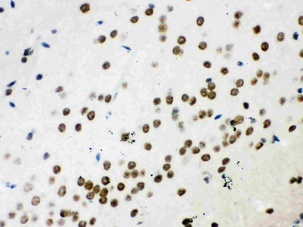 Anti-Wnt2b